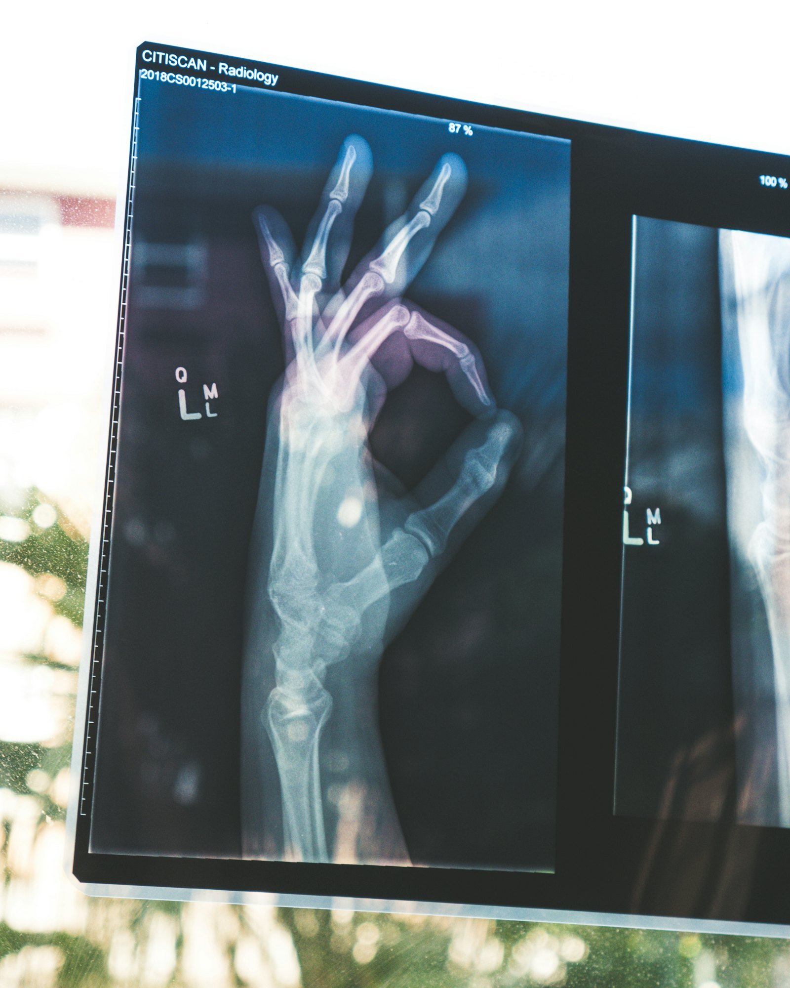 What Is a DEXA Scan and Who Should Get One?